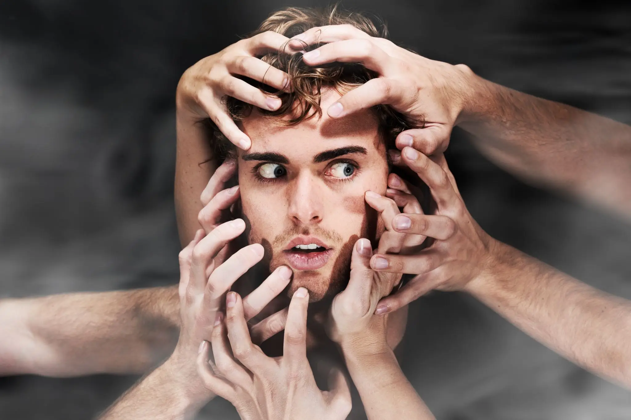 Rosto de um homem jovem com cabelo castanho claro e olhos azuis arregalados, olhando para o lado com uma expressão de surpresa ou angústia. Múltiplas mãos de diferentes pessoas tocam e seguram sua cabeça e rosto, simbolizando pressão, estresse, confusão ou sobrecarga mental. O fundo é escuro e desfocado, destacando o drama da cena.